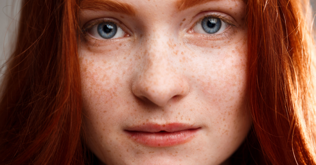 How To Get Rid Of Age Spots 6 Effective Ways.